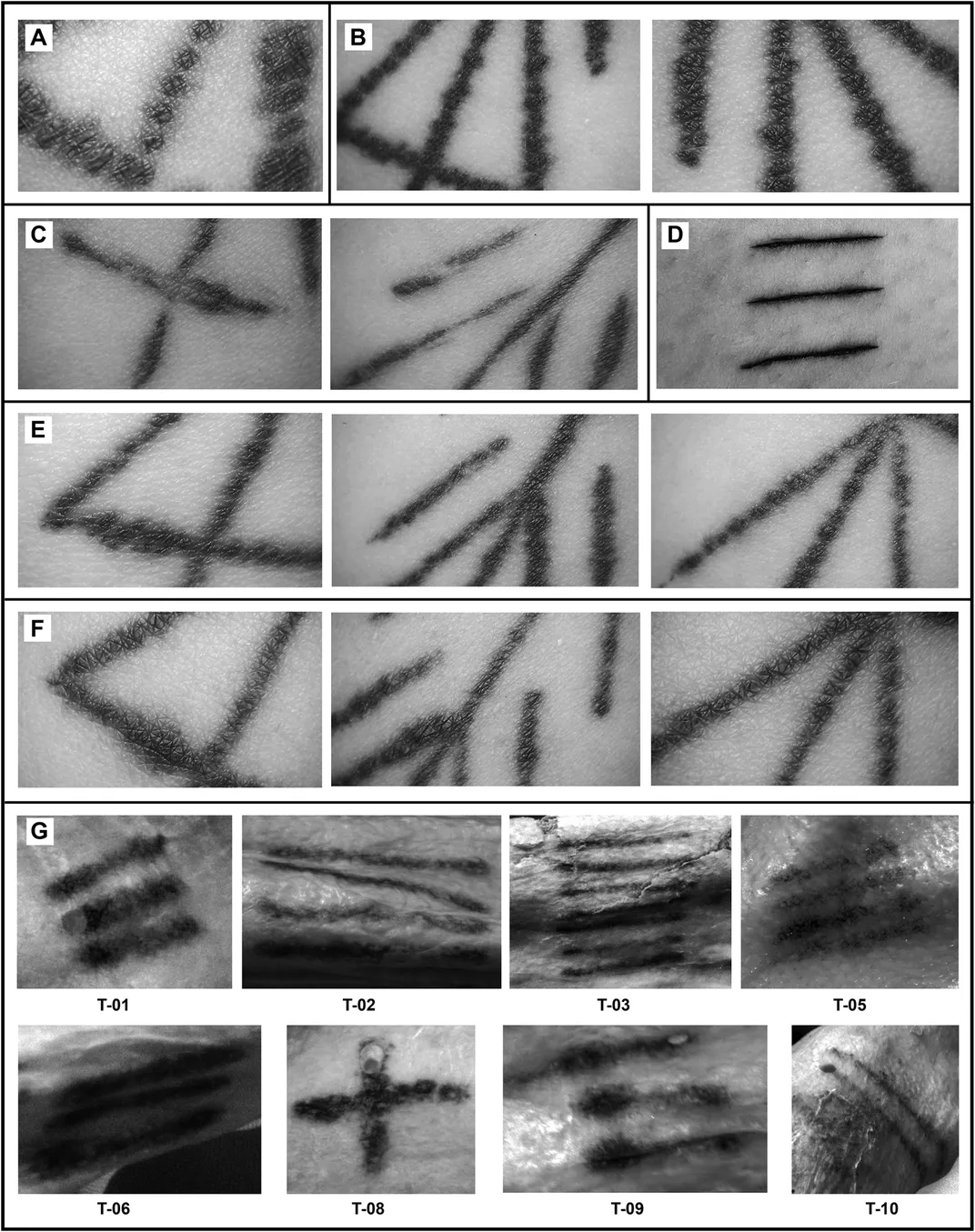 Multiple images of dark lines on skin